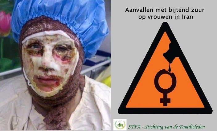Aanvallen met bijtend zuur op vrouwen markeren politieke verdeeldheid